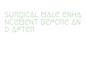 surgical male enhancement before and after