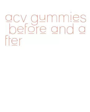 acv gummies before and after